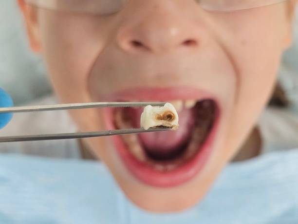Best Emergency Care for Gum Disease in Galva, KS
