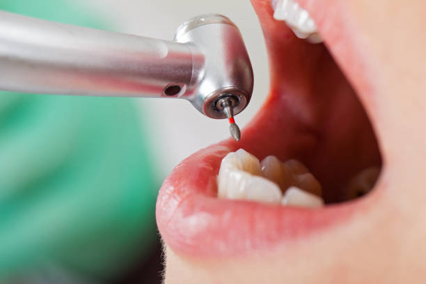 Best Dental Abscess Treatment in Galva, KS